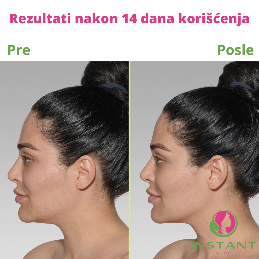 Instant Facelifting™- Maska za zatezanje lica