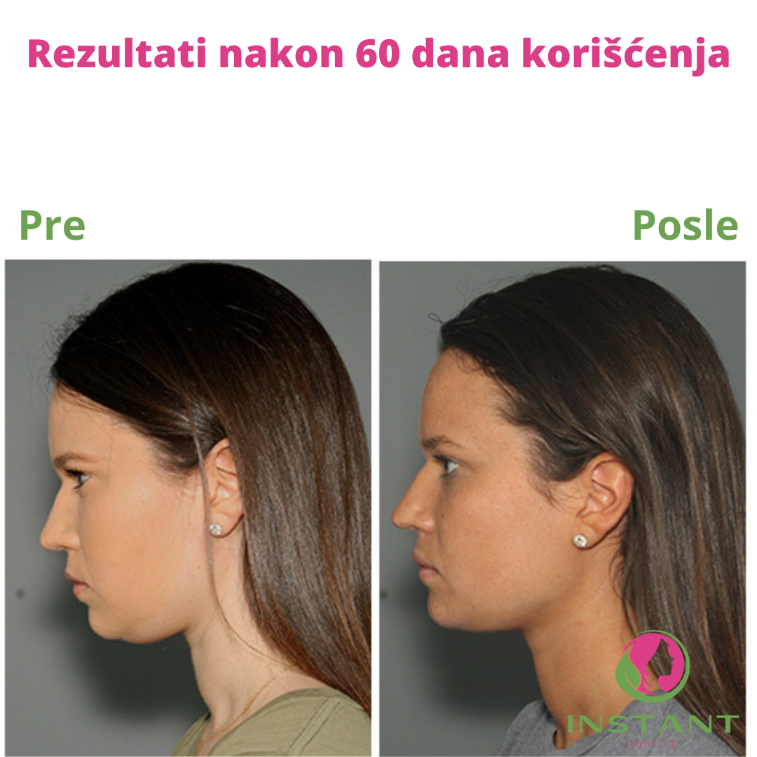 Instant Facelifting™- Maska za zatezanje lica
